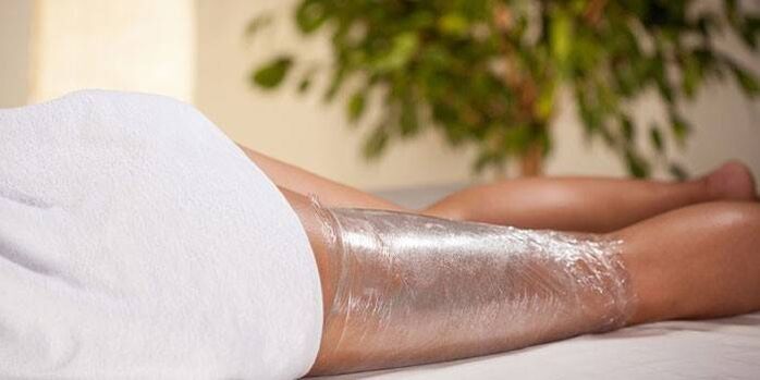 meáchain caillteanas cuimsitheach sa bhaile